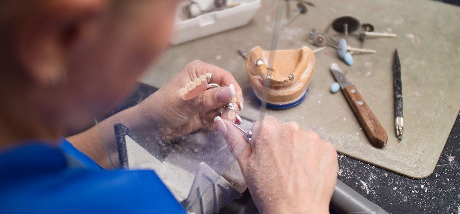 Reparaturarbeit an einer Prothese