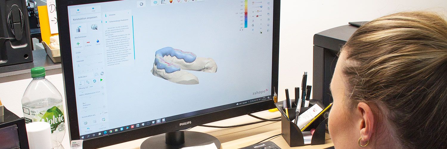 Eine Zahnschiene visuell dargestellt